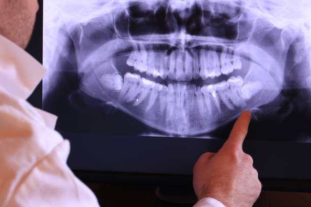 Best Pediatric Emergency Dentist in Richfield, WI