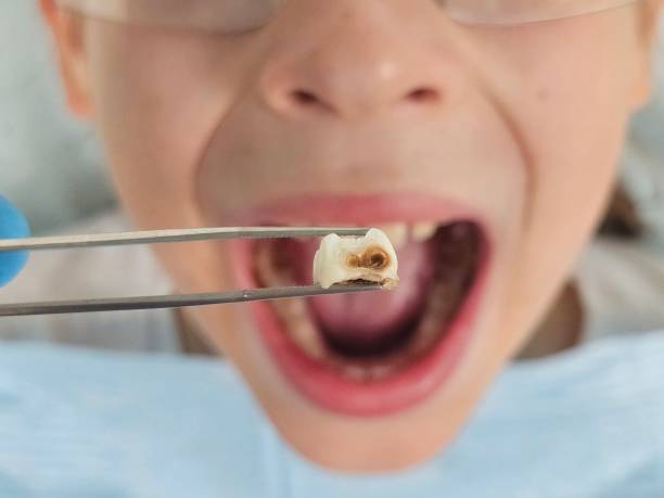 Best Weekend Emergency Dentist in Richfield, WI