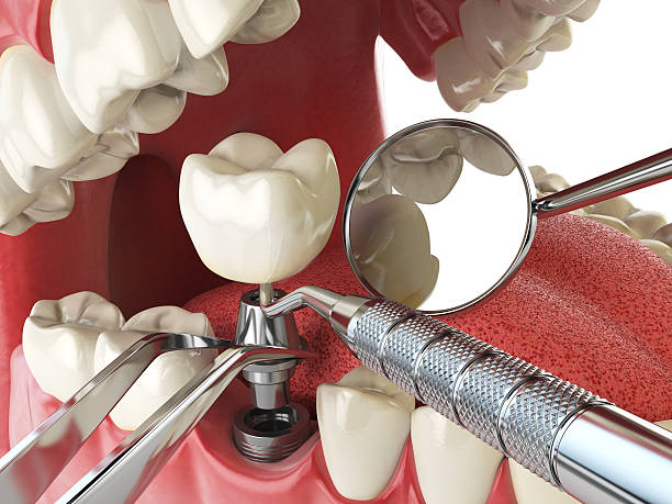 Best Emergency Dental Services for Seniors in Richfield, WI